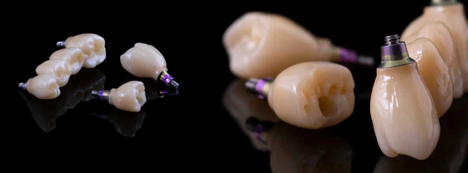 Keramik von T.K.dent Dentallabor GmbH